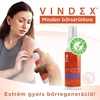 WTN Vindex TM Bőrkondícionáló spray felületi sérülésekre 100 ml WTN Vindex TM Bőrkondícionáló spray felületi sérülésekre 100 ml